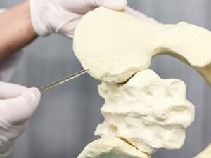 Un robot guidé par IRM réalise une deuxième biopsie osseuse pédiatrique